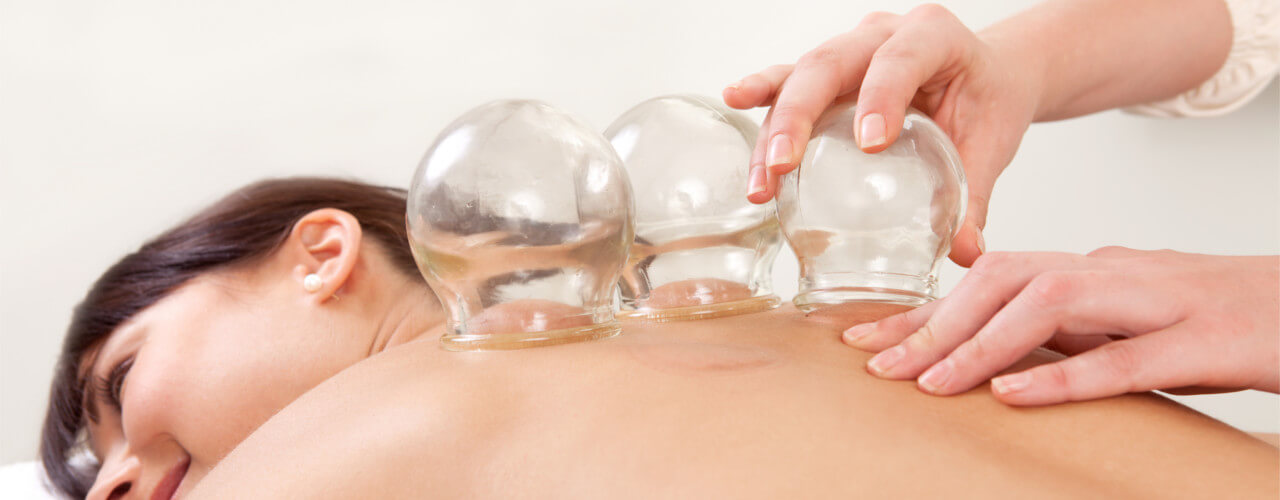 Cupping therapy Melbourne